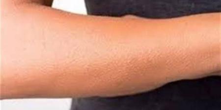 تفسير رؤية الجلد في المنام وعلاقتها بوجود بعض الأصدقاء المنافقين - المدينة برس