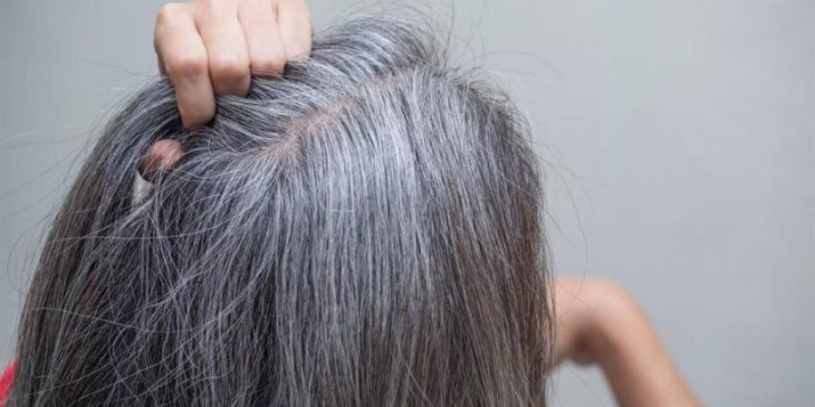 وصفة طبيعية للعناية بالشعر الأبيض ومنحه لونا داكنا - المدينة برس
