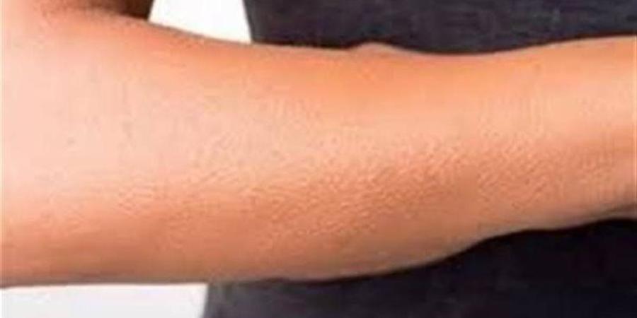 تفسير رؤية الجلد في المنام وعلاقتها بوجود بعض الأصدقاء المنافقين - المدينة برس