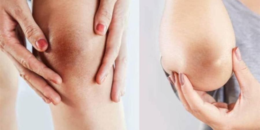 أسباب زيادة اسمرار الركبتين والكوعين في الصيف وطرق العلاج - المدينة برس